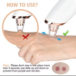 Removedor  de espinillas y limpia poros